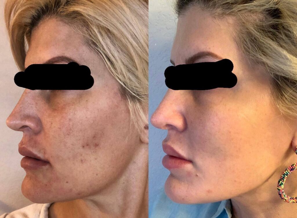 242608148_414320193370929_2507913365916349270_n