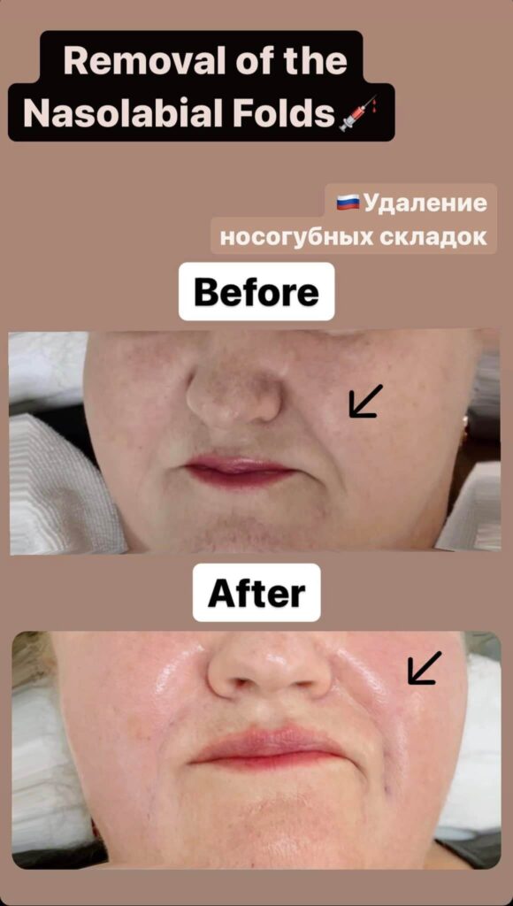 268462238_465921854877429_2261207586544316908_n