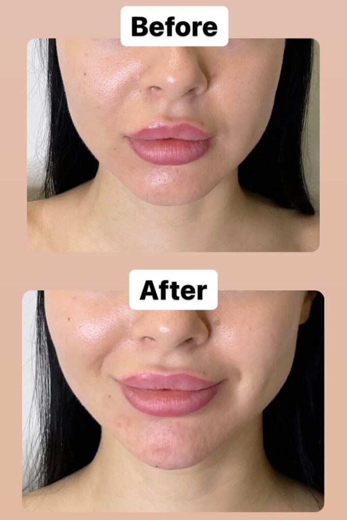 269887230_472795844190030_5362304568773509683_n-e1659718466675