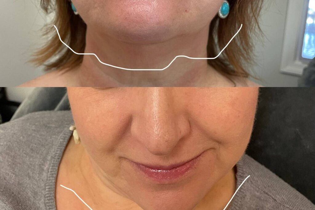 274605267_507272340742380_7272660676232120257_n