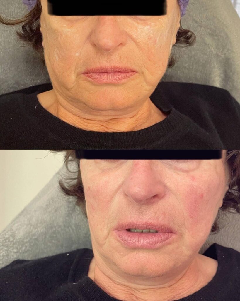 277347726_526409912161956_6346340985155236000_n