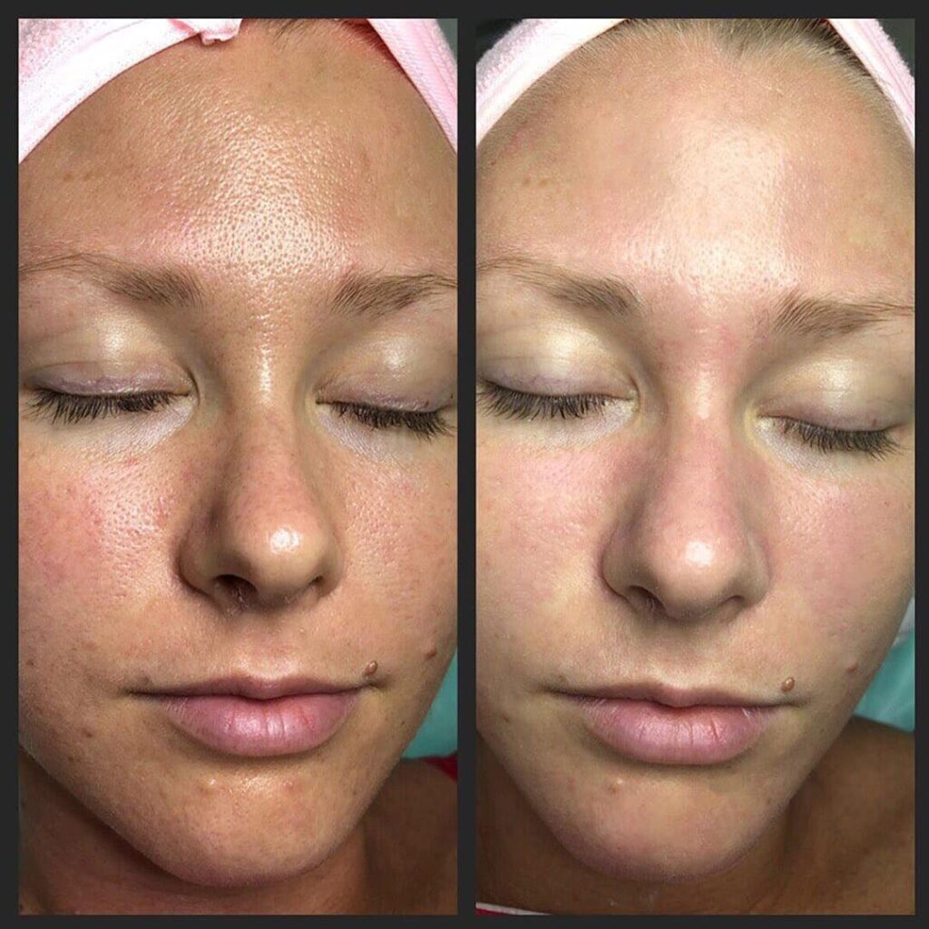 278322292_536228271180120_3022223221208734729_n