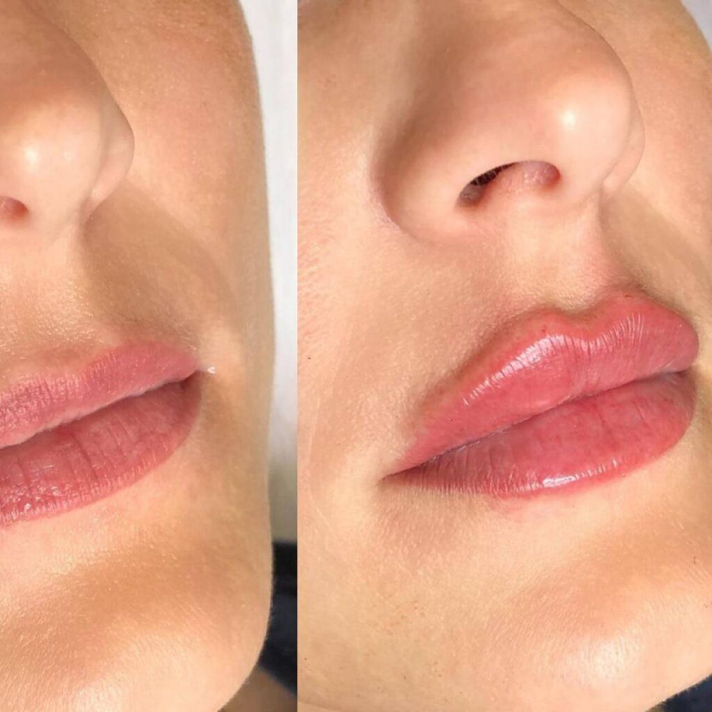 295546313_513686767342613_8319048341103116982_n